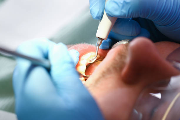 Best Cracked Tooth Emergency Dentist  in Roslyn, NY